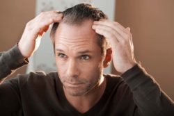 Man losing hair