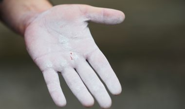 Hand covered in baby powder