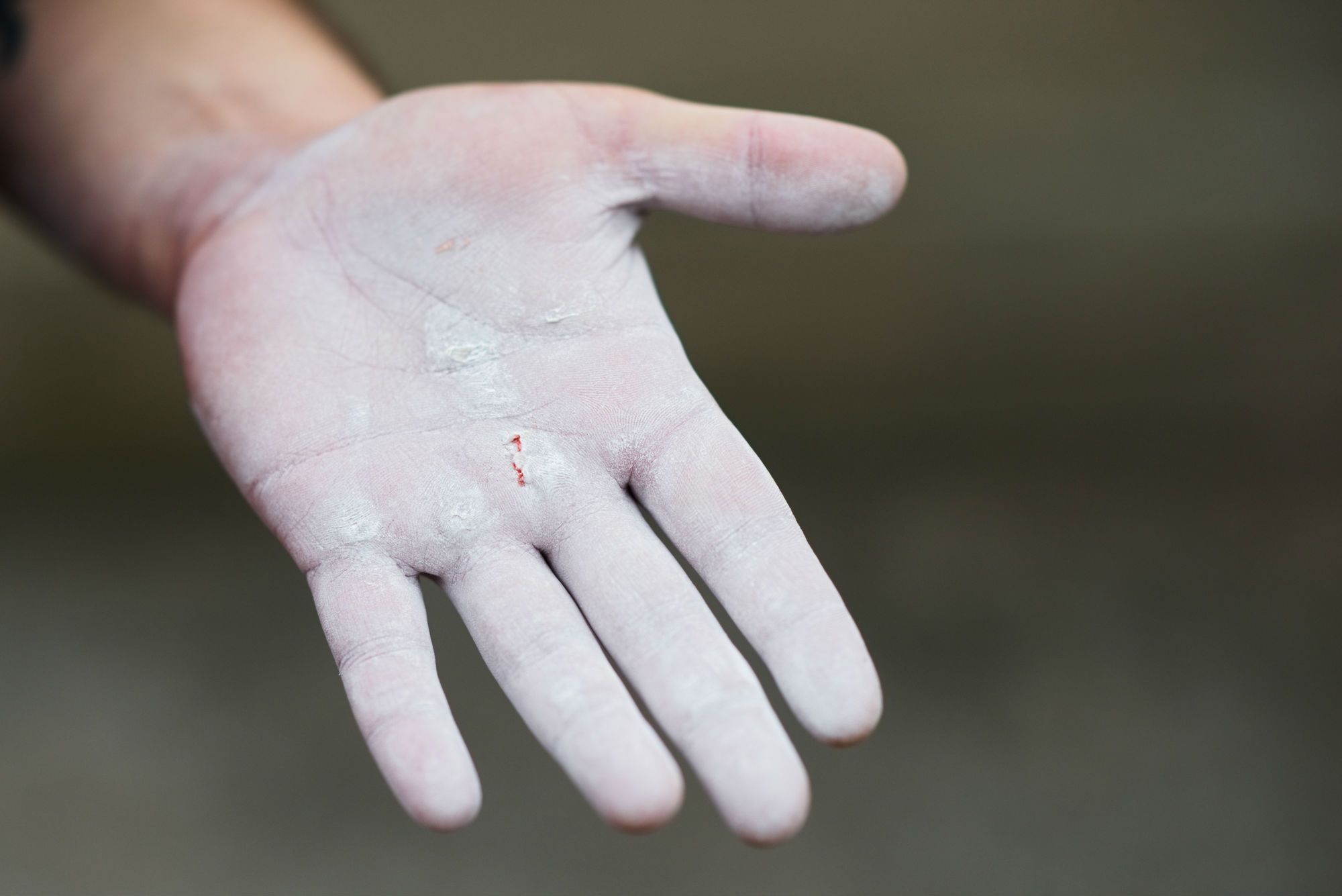 Hand covered in baby powder