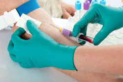 Patients taking tenofovir disoproxil may be at risk for kidney failure.