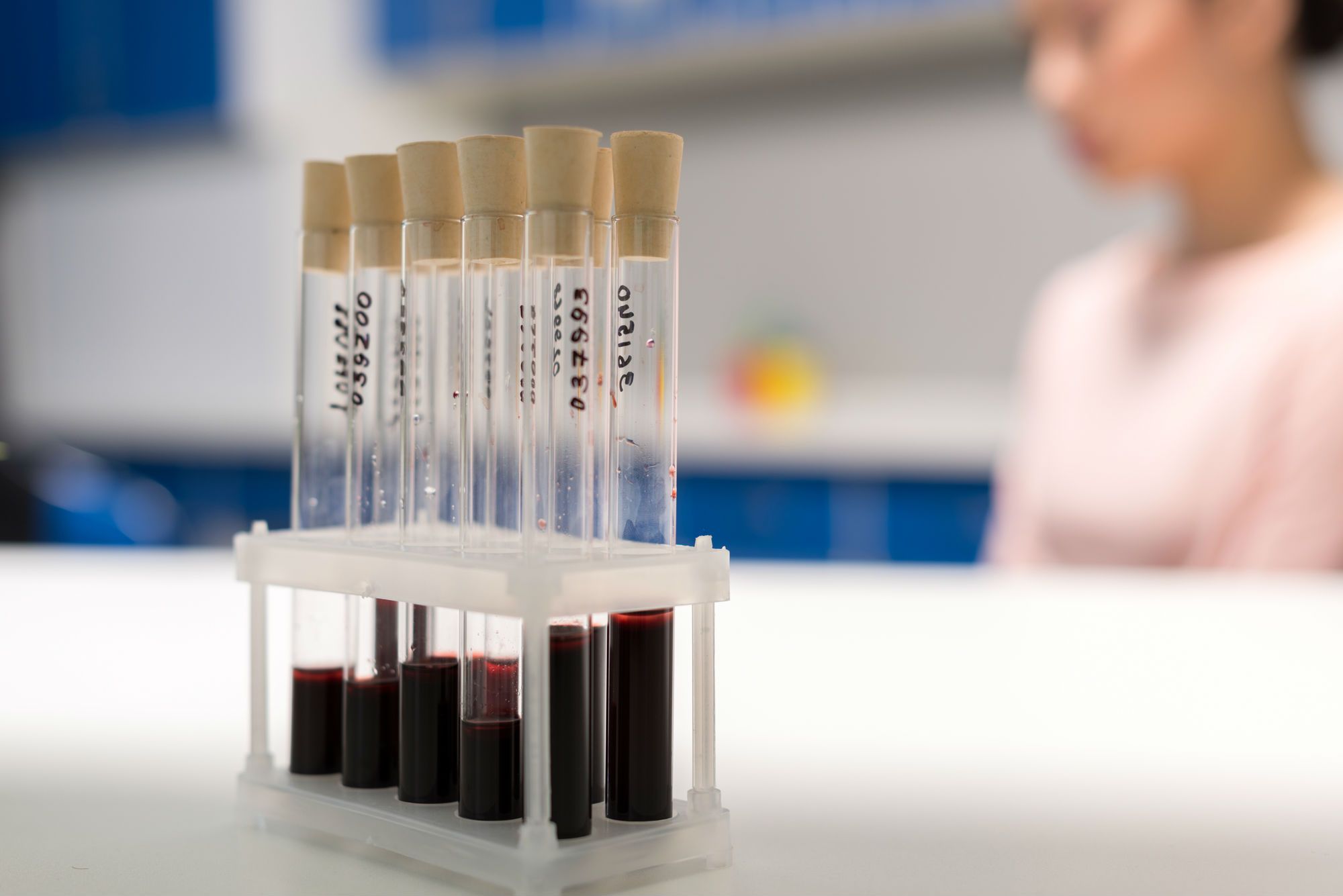 Tubes with samples of blood