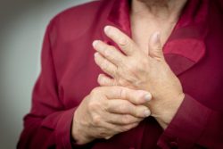 Woman with arthritic hand