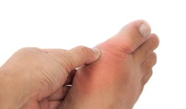 A heart attack is a possible side effect of Uloric, a drug to treat gout.