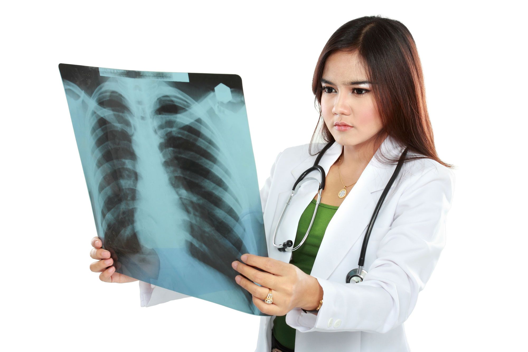 In addition to smoking, adenocarcinoma of the lung can be caused by asbestos exposure.