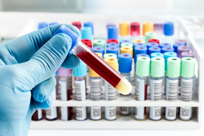 labcorp blood testing exposed in data breach