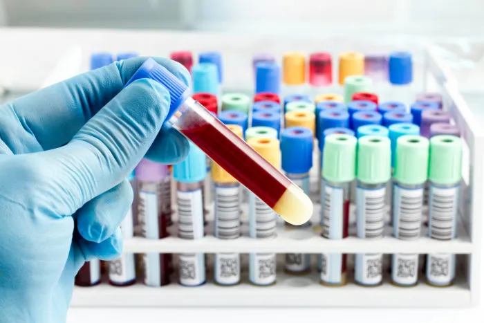 labcorp blood testing exposed in data breach