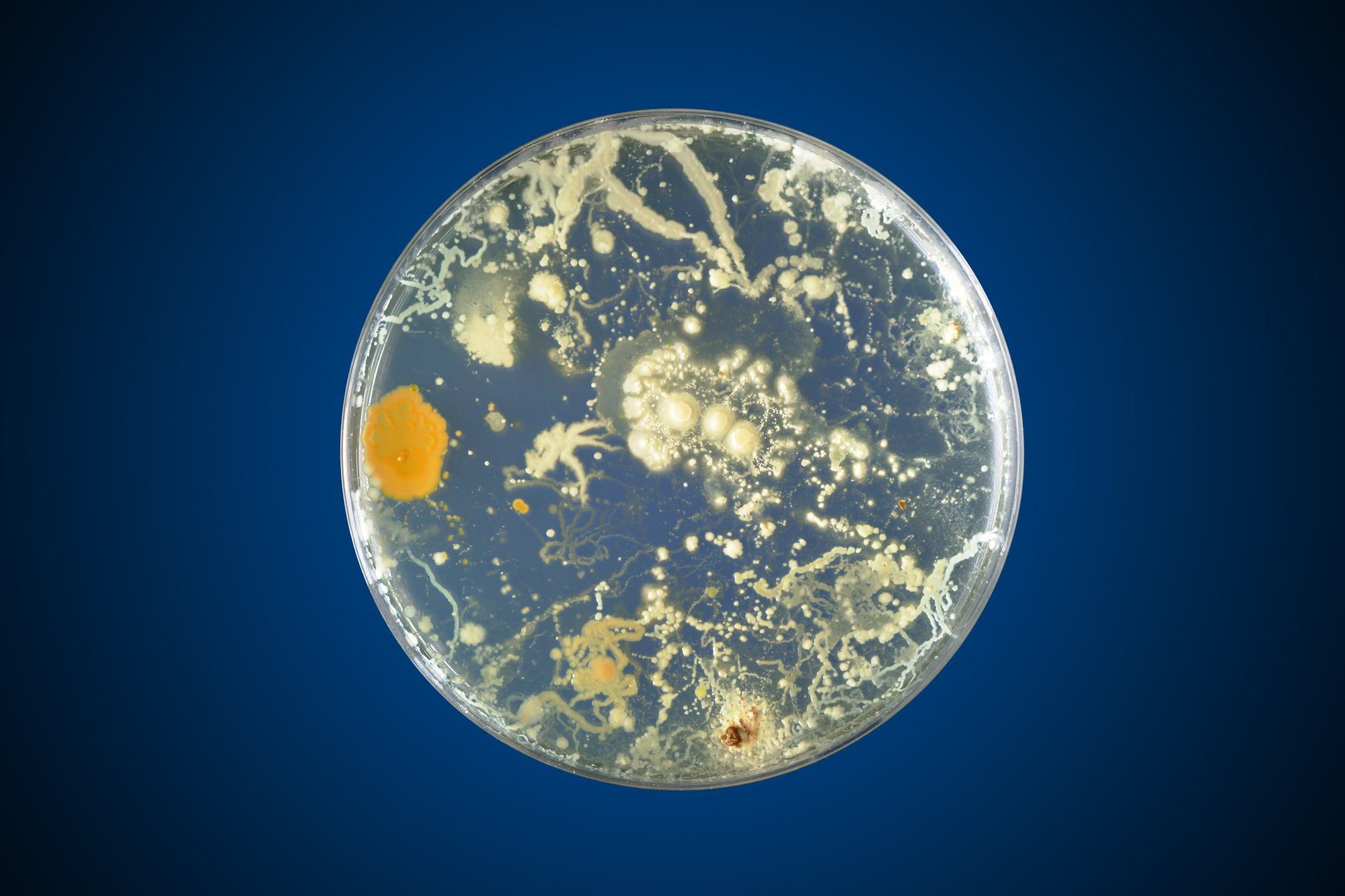 bacteria in petri dish