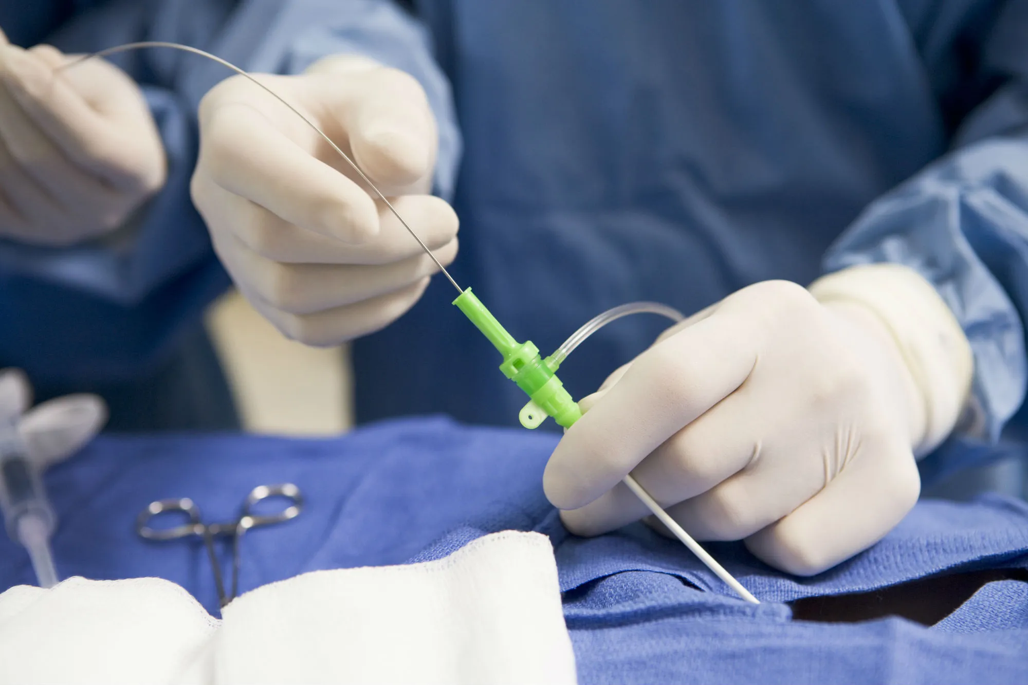 There is more than one way to remove an IVC filter.