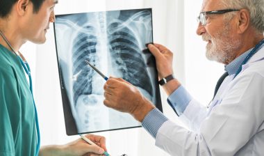 Two doctors discuss a chest X-ray.