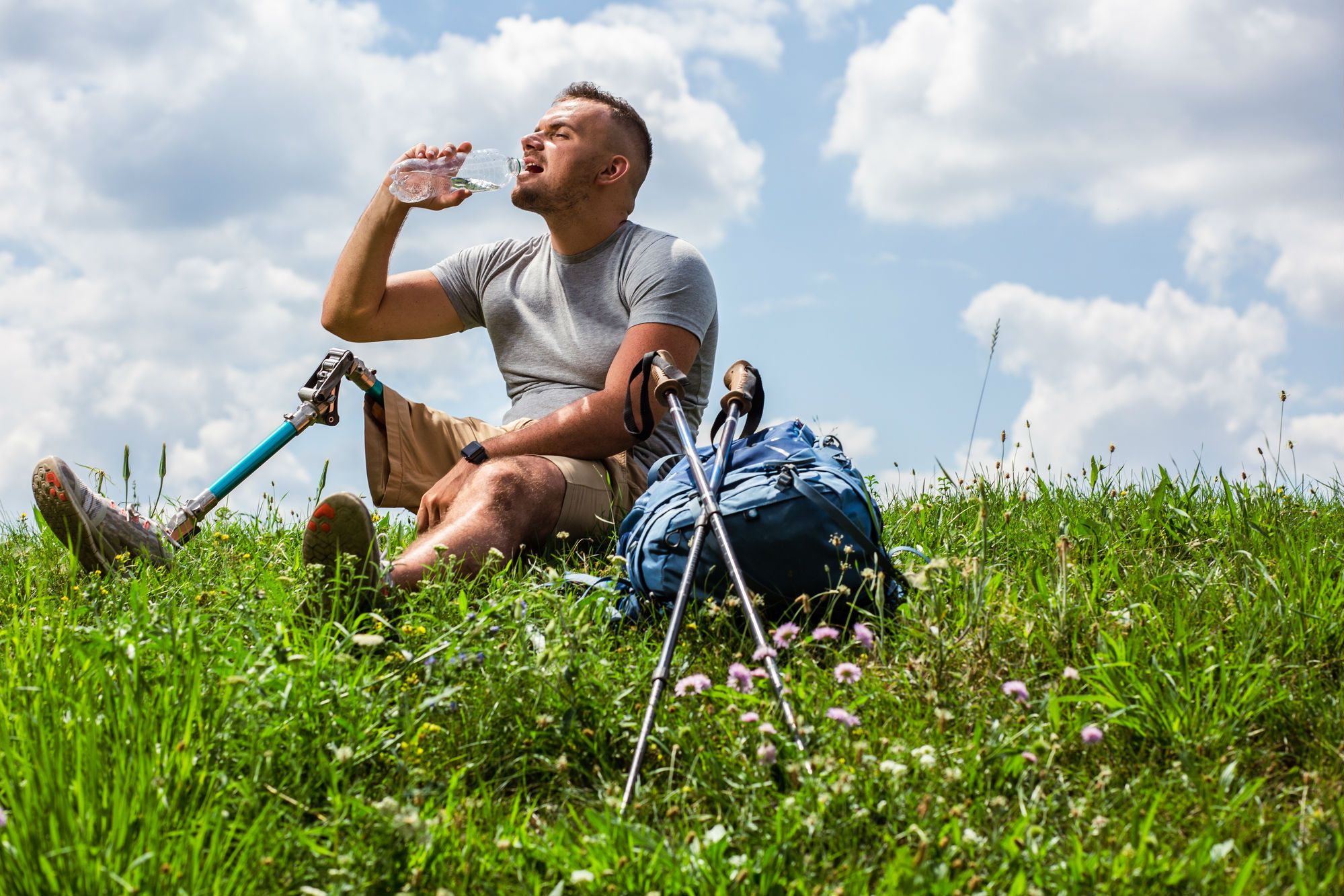 Are You a Severely Injured Servicemember?