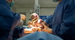Baby born via c section regarding induced labor class action