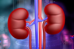 Heartburn medication causing kidney failure is becoming more of a problem