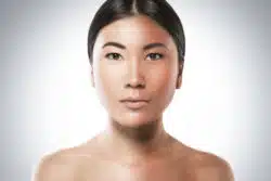 woman with two skin tones regarding unauthorized skin lightening products being seized