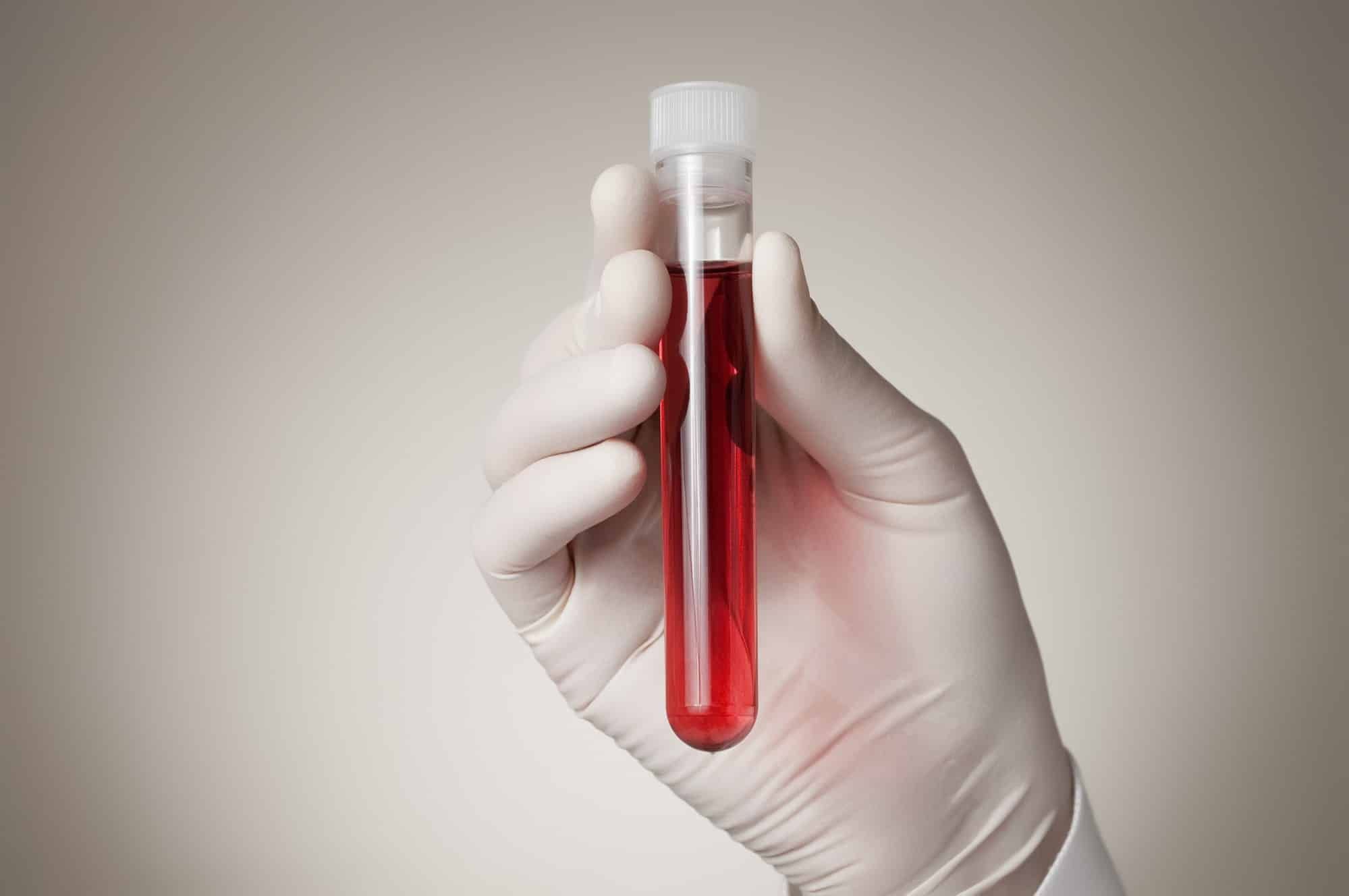 Theranos blood test advertising allegedly took advantage of consumers.
