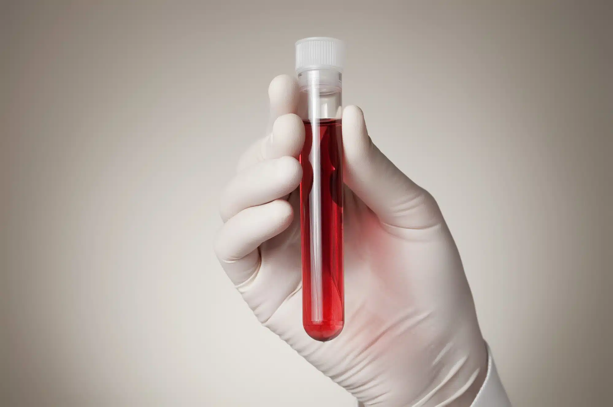 Theranos blood test advertising allegedly took advantage of consumers.