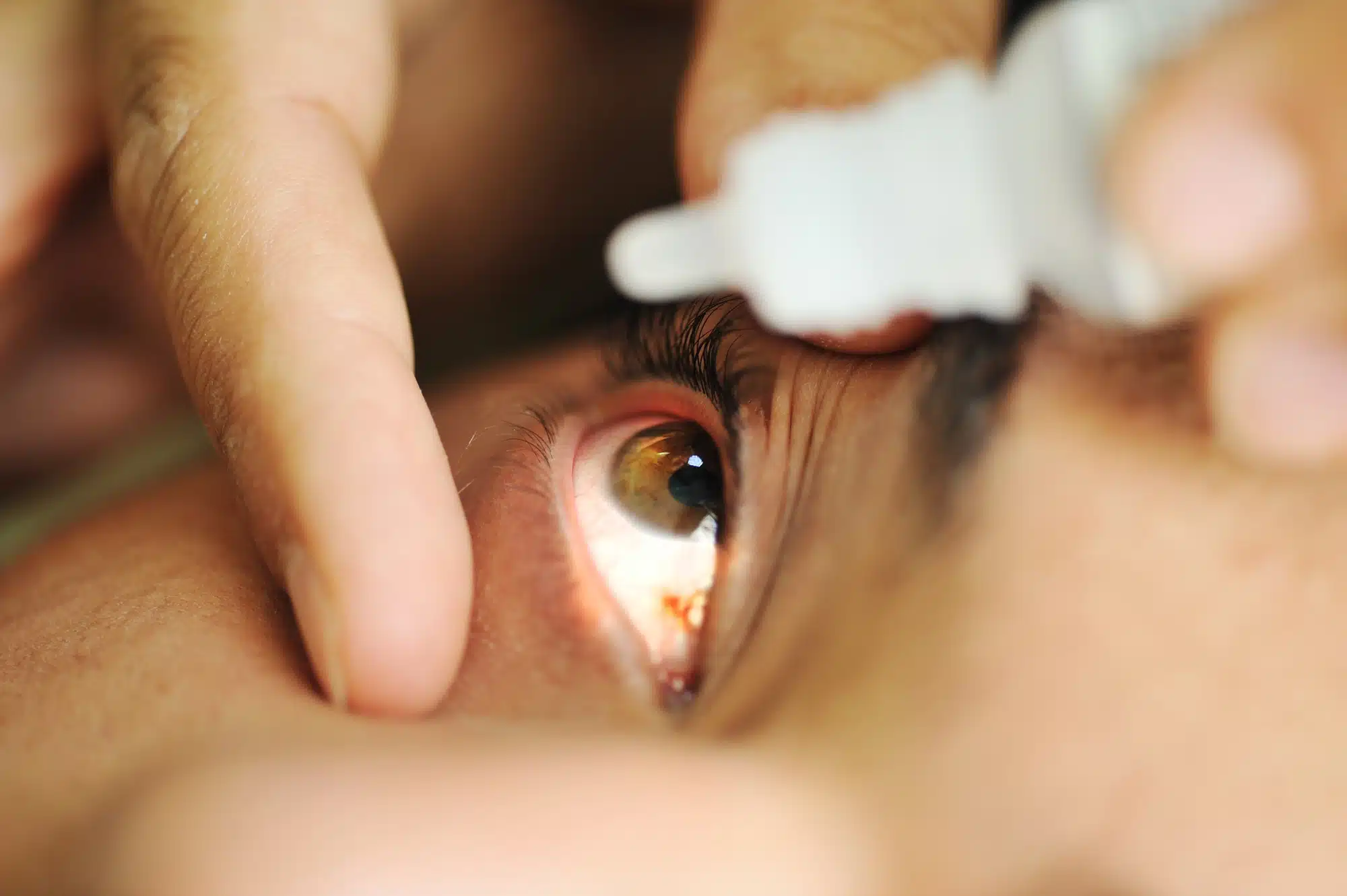 close up of man putting in eye drops