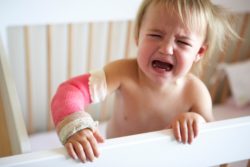 infant with broken arm in cast