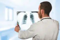 People with asthma shouldn't vape.