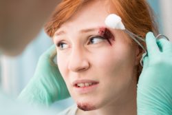 PIP lawsuit in Florida