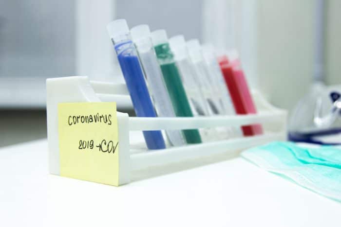 A COVID-19 test maker allegedly decieved customers with claims of 100 percent accuracy.