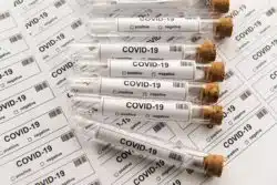 COVID-19 tests result