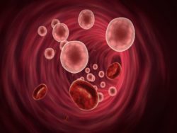 What are the side effects of an IVC filter?