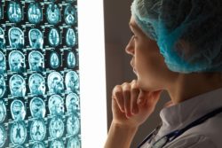 Cerebellar atrophy