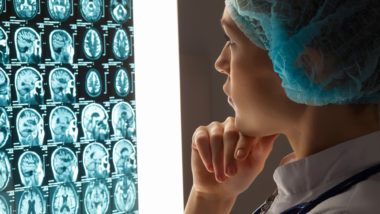 Cerebellar atrophy