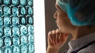 Cerebellar atrophy