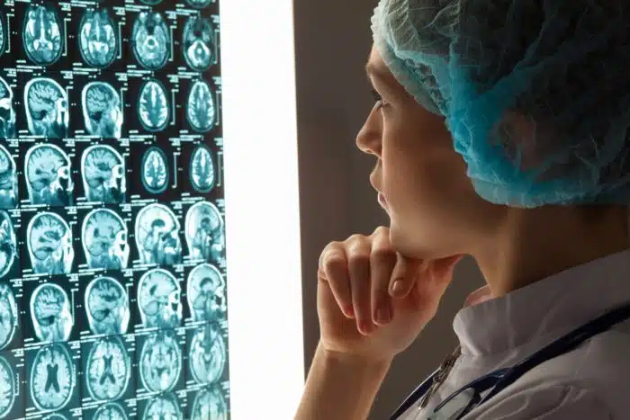 Cerebellar atrophy