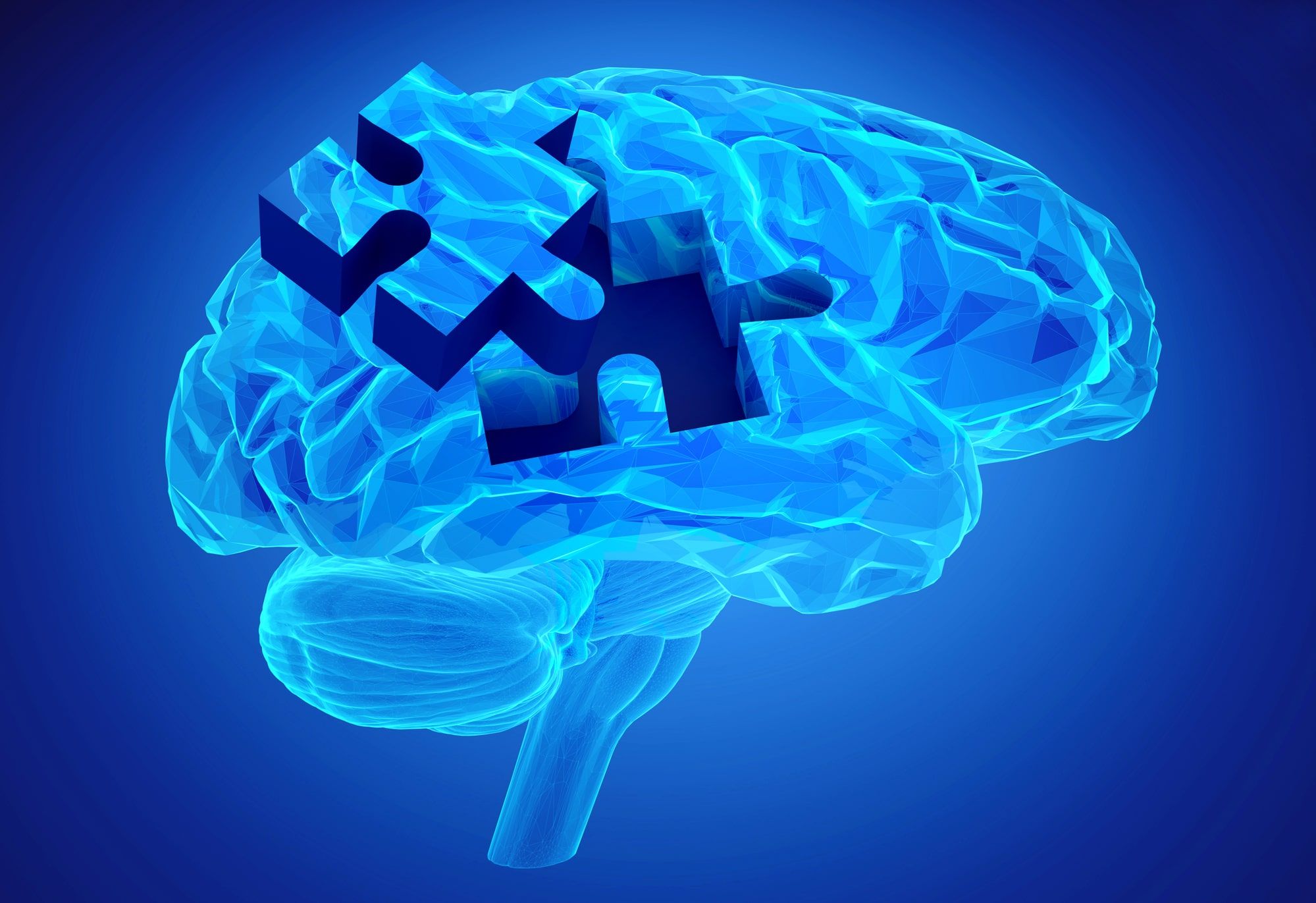 Scan of human brain with memory loss