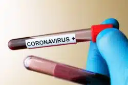 Positive blood test for COVID-19