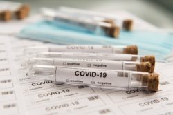 Testing for COVID helps keep farmworkers and the food supply safe, authorities argue.
