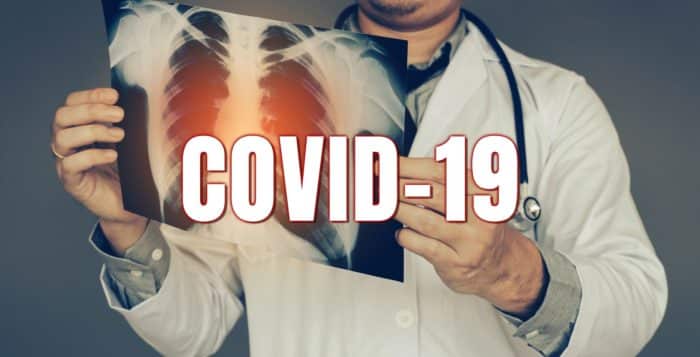 Doctor holding up covid-19 x-ray