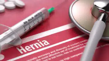 Hernia mesh defects are causing extra surgeries and issues for patients
