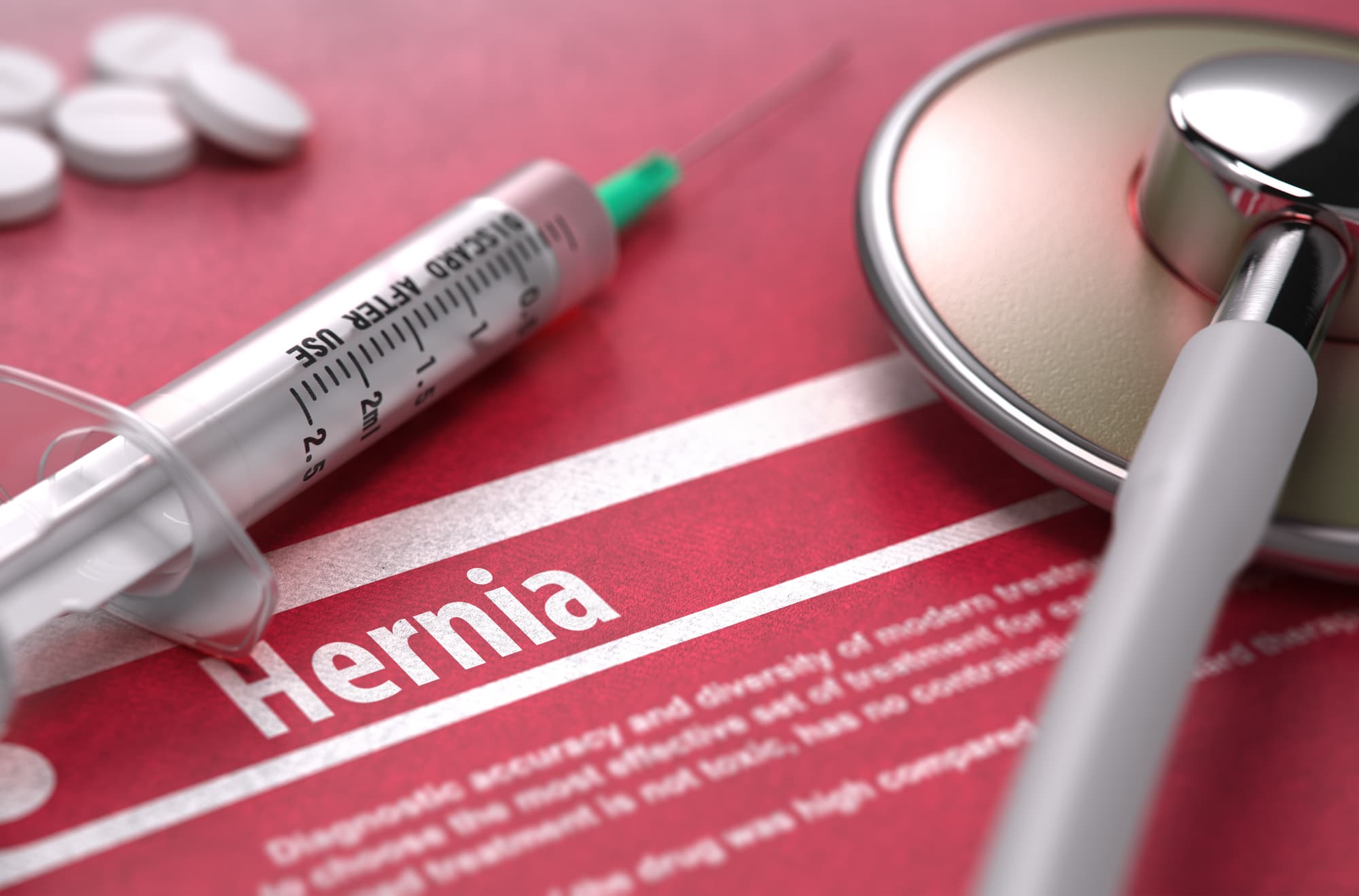 Hernia mesh lawsuit complications, failure & recall LaptrinhX / News