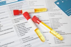 urine samples at the lab