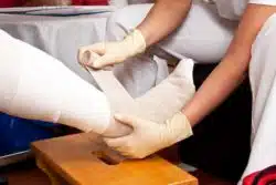 Nurse dressing a leg wound