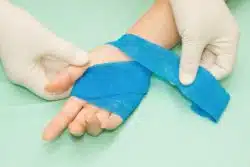 Wounded hand being wrapped in blue bandage
