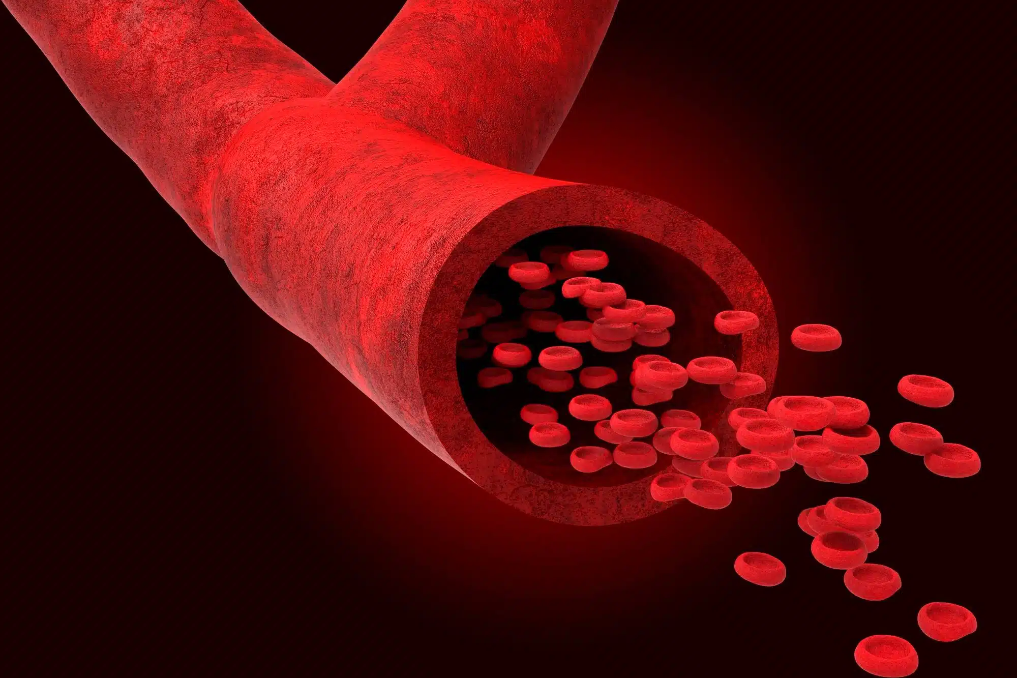 Why are there Penumbra catheter deaths?