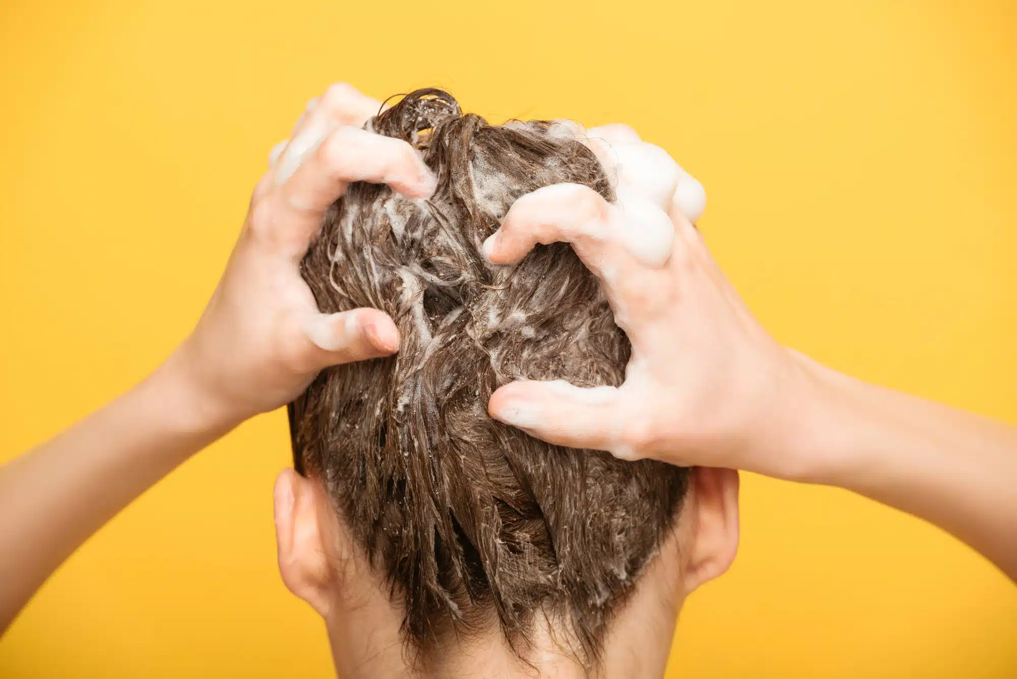 Class action claims Selsun Blue causes scalp irritation and hair loss