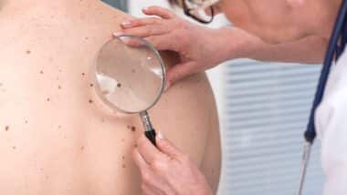 Picato skin gel has given people skin cancer, according to a class action lawsuit.
