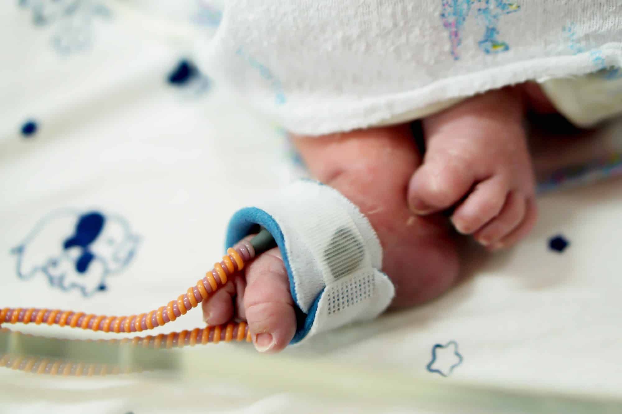 baby with birth injury