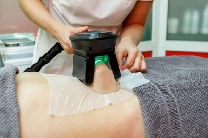 CoolSculpting Weight Loss Procedure Customers File Class Action Lawsuit Alleging Bodily Deformation