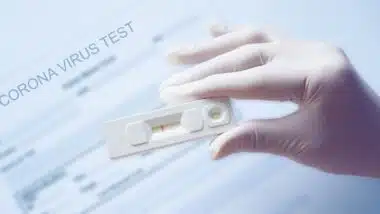 Doctor holding a test kit for viral disease