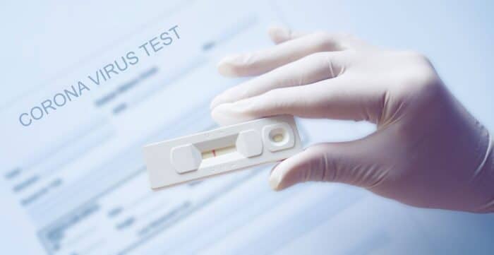 Doctor holding a test kit for viral disease