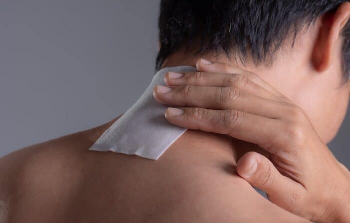 Close up of a lidocaine patch on the back of a man’s neck.