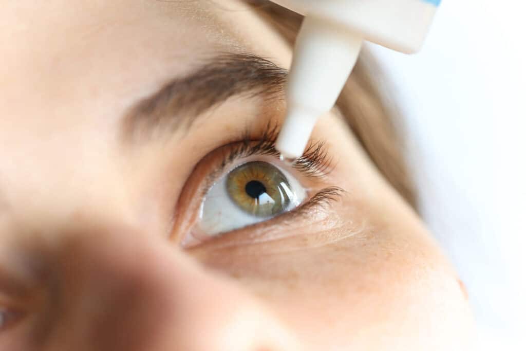 Close up of woman putting eyedrops in her eyes, representing the Amazon and EzriCare lawsuit.