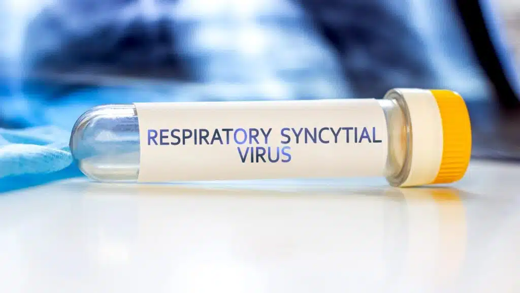 Respiratory Syncytial Virus with lung ct scan aside on light blue background. RSV disease concept