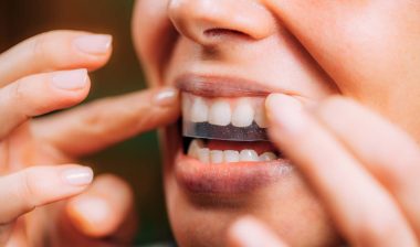 Close up of a woman putting a whitening strip on her teeth, representing the Lumineux tenth whitener class action.